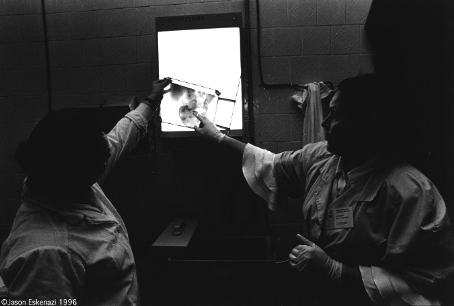 A doctor and a technician examine an x-ray of a woman who has had many abortions to determine whether it is safe for her to endure another.