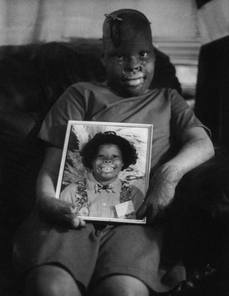 Delenna, 6, poses with her picture. She has paid a heavy price for inner-city living in her young life. Photo by John Sundlof